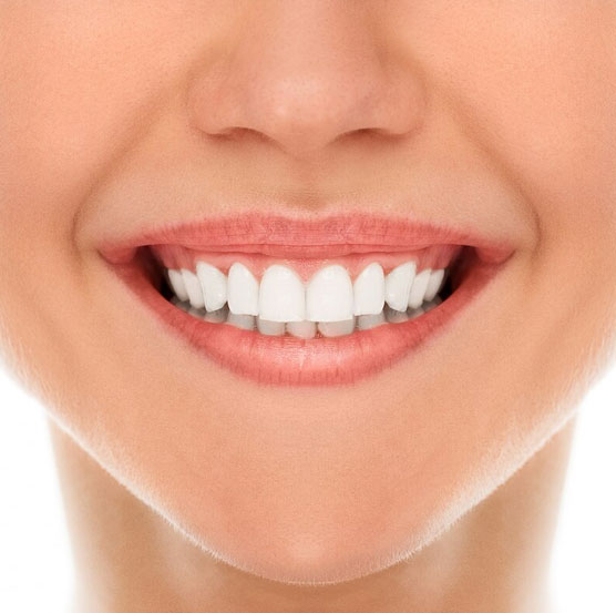 dental-img16