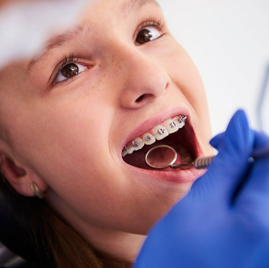 dental-img19