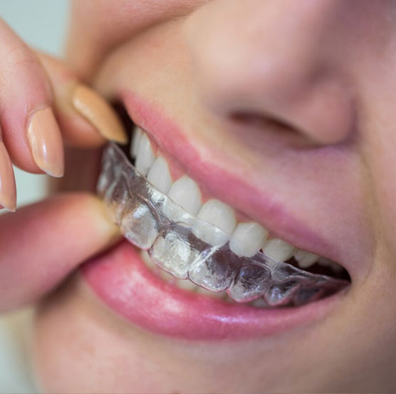 dental-img26