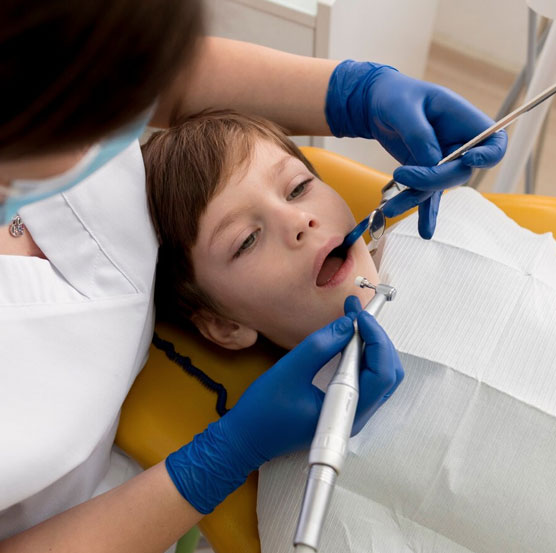 dental-img27