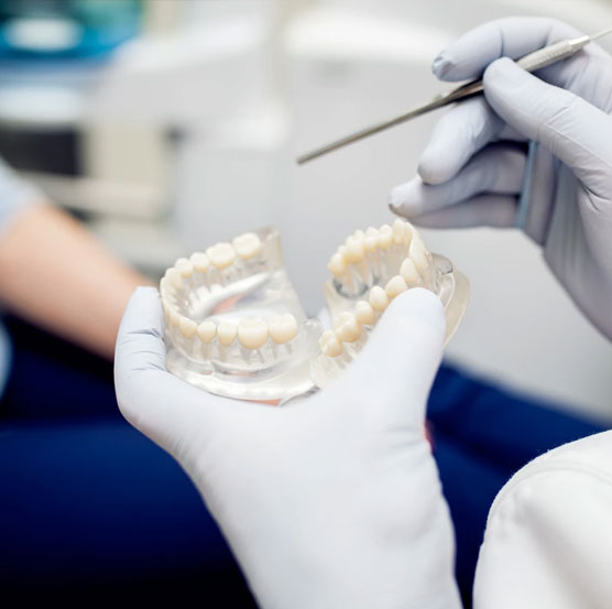 Porcelain crowns