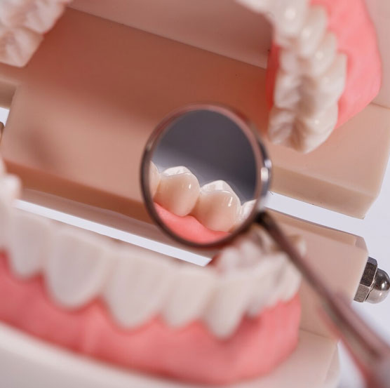 dental-img32
