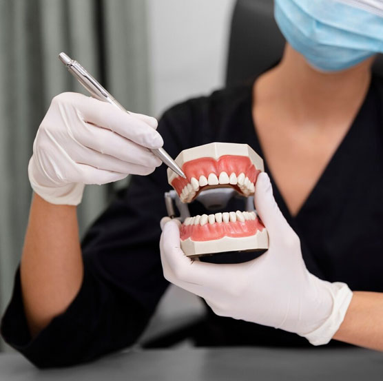 dental-img33