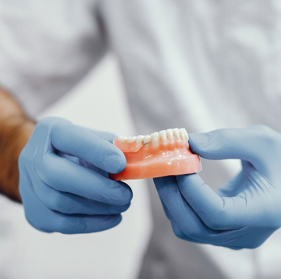 dental-img34