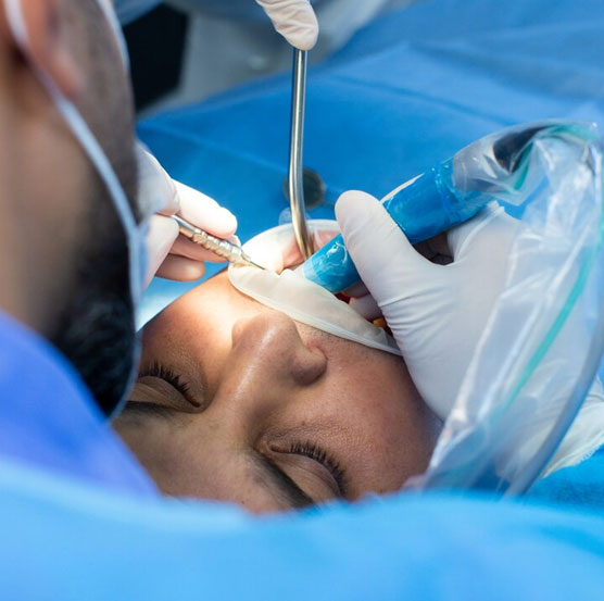 Oral surgery