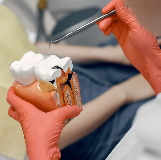 dental-img38