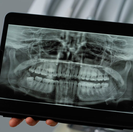 dental-img43