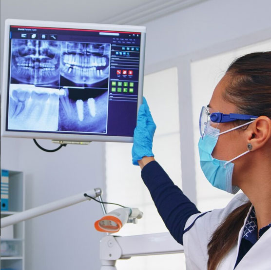 Digital X-ray