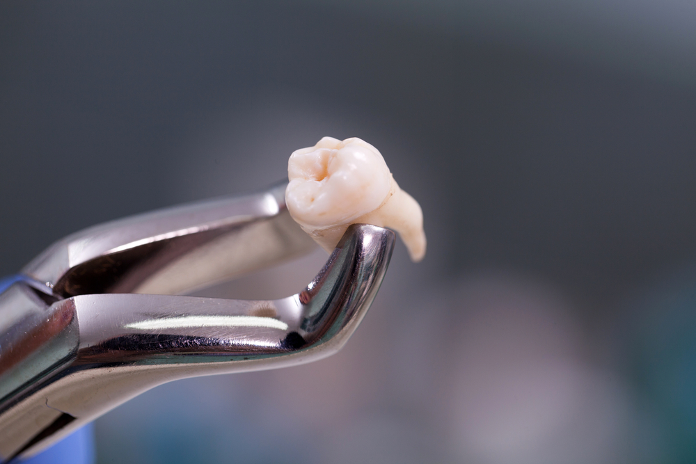 cavity signs